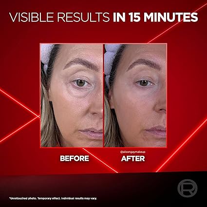 L'Oréal Paris Revitalift Laser Instant Eye Bag Eraser, Clinically proven, Results in 15 minutes, Dramatic instant tightening & smoothing effect to reduce under-eye bags and wrinkles